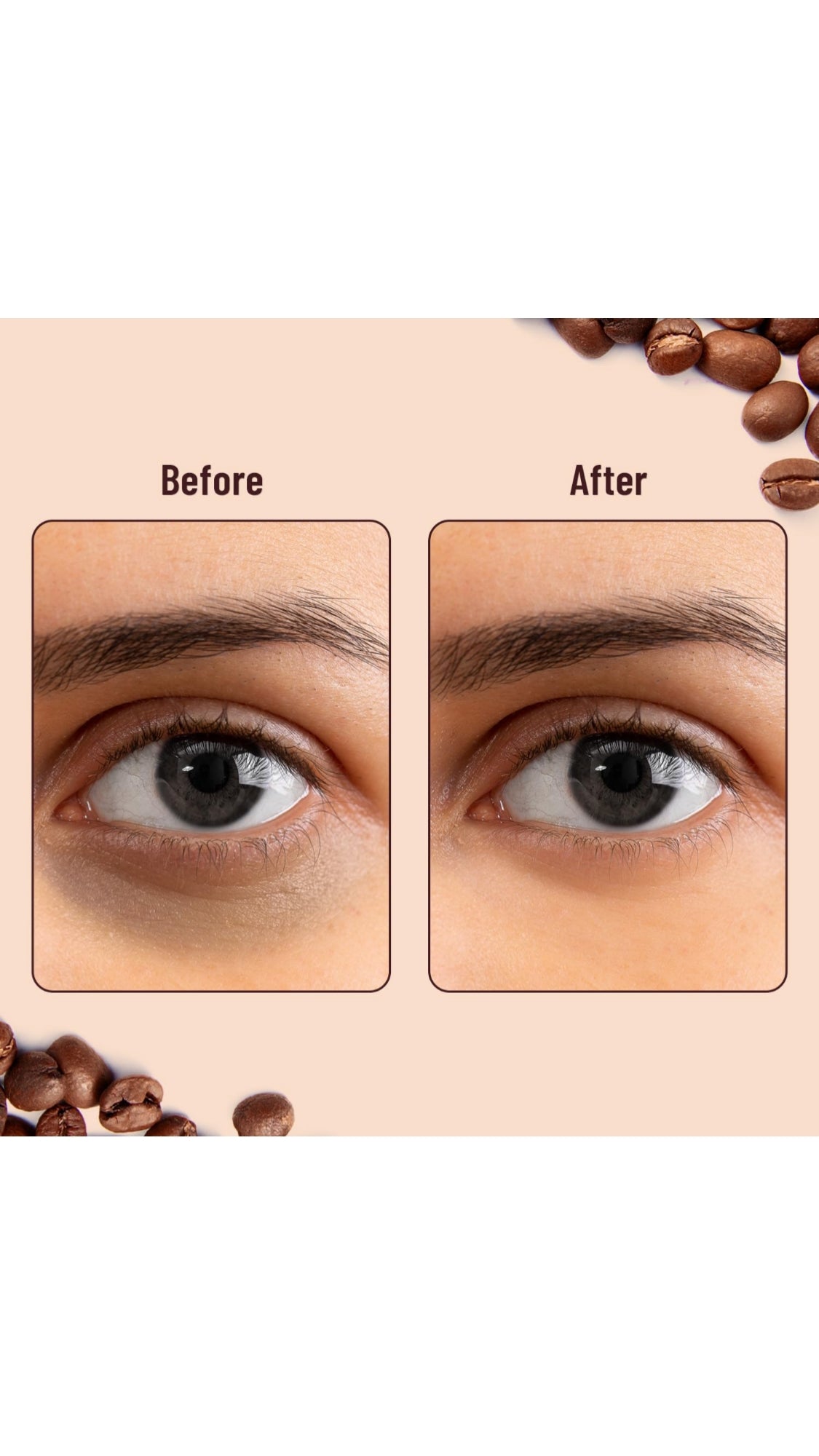 Swiss Beauty Hydra Anti Wrinkle Eye Serum Patch| Treats Dark Circles, Fine Lines And Wrinkles