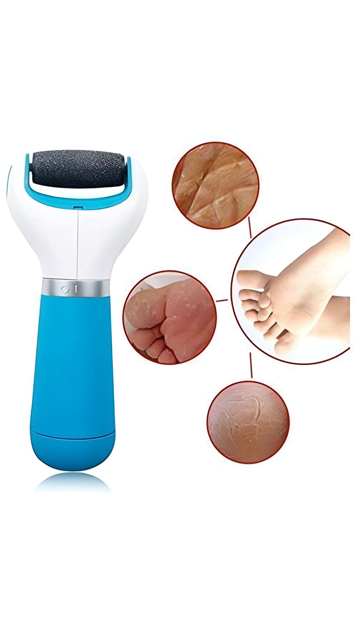 Mini Foot Scrubber for Dead Skin, Callus Remover for Feet, Smooth and Soft Feet, Cracked Heels Remover Rechargeable Battery