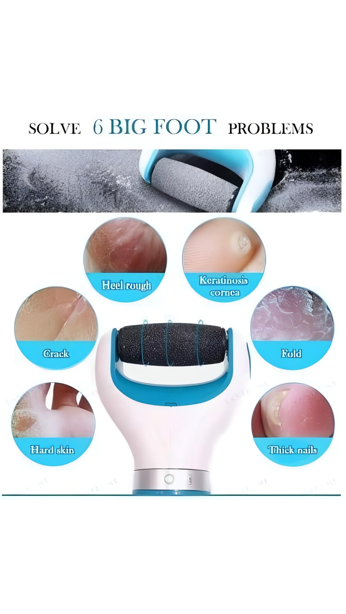 Mini Foot Scrubber for Dead Skin, Callus Remover for Feet, Smooth and Soft Feet, Cracked Heels Remover Rechargeable Battery